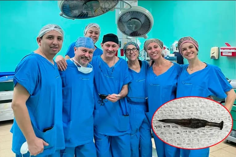 Hito en la salud pública: salvaron a un niño tras extraerle un clavo del intestino con innovadora cirugía sin cicatrices - imagen de origen