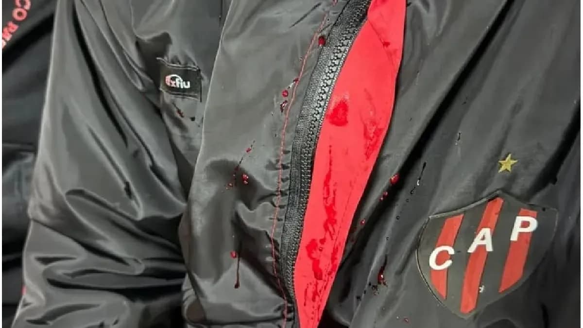 Rompió el silencio uno de los jugadores de Patronato atacado por la barra: “Me dieron con la culata de un arma” - imagen de origen