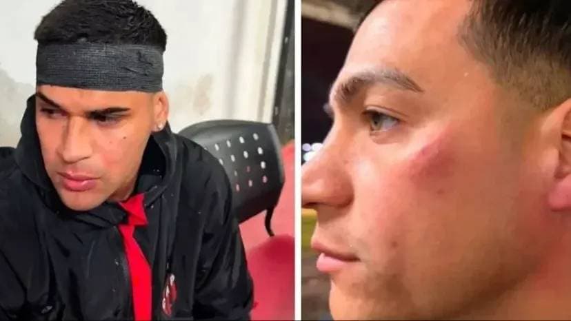 La barra de Patronato encañonó y atacó a culatazos a futbolistas tras la derrota ante Colón de Santa Fe - imagen de origen
