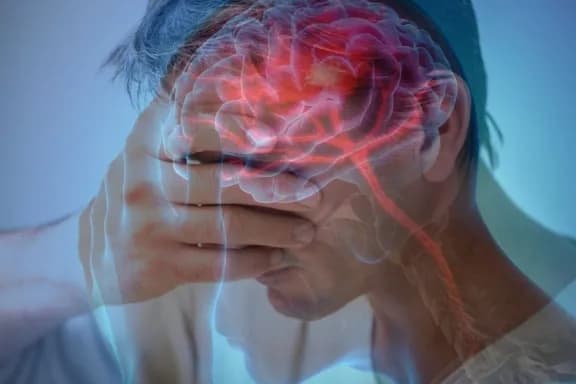 ACV: Cómo reconocerlo y por qué cada minuto es vital para salvar vidas - imagen de origen