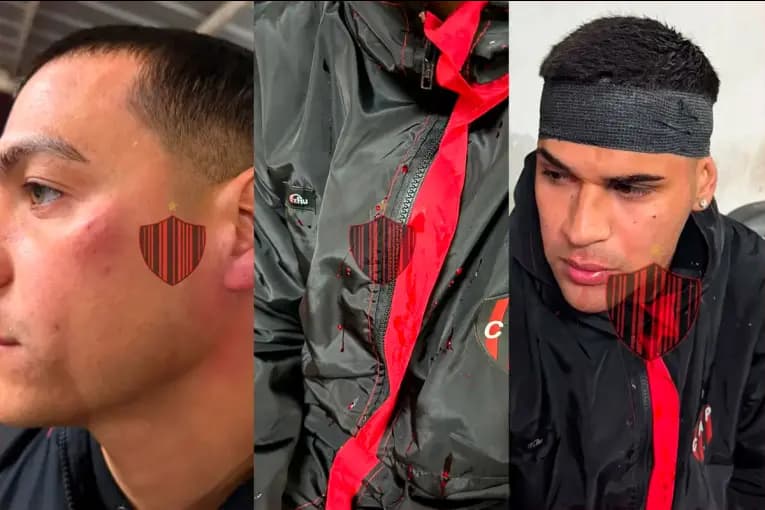 Investigan presunta agresión a jugadores de Patronato tras la derrota ante Colón - imagen de origen
