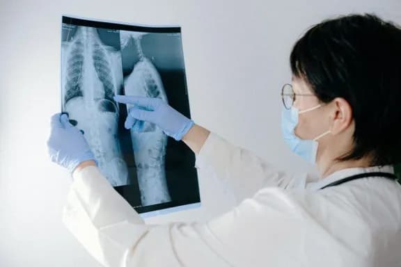 Ofrecerán una charla abierta sobre tuberculosis en el CAPS Pueblo Nuevo - imagen de origen